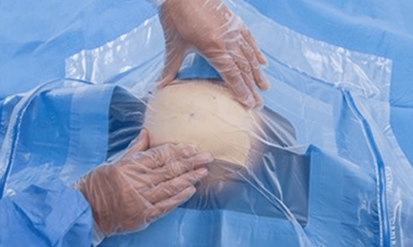 Craniotomy Drape