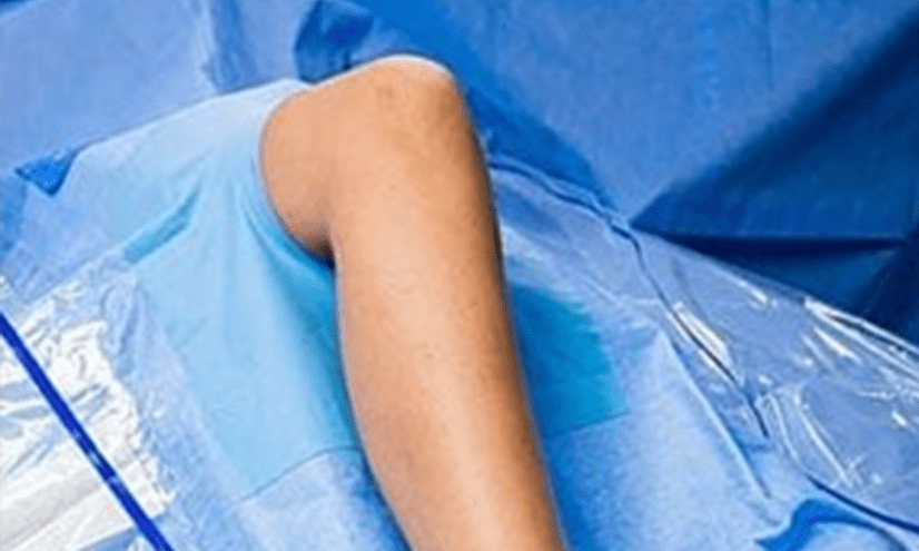 Knee O Drape