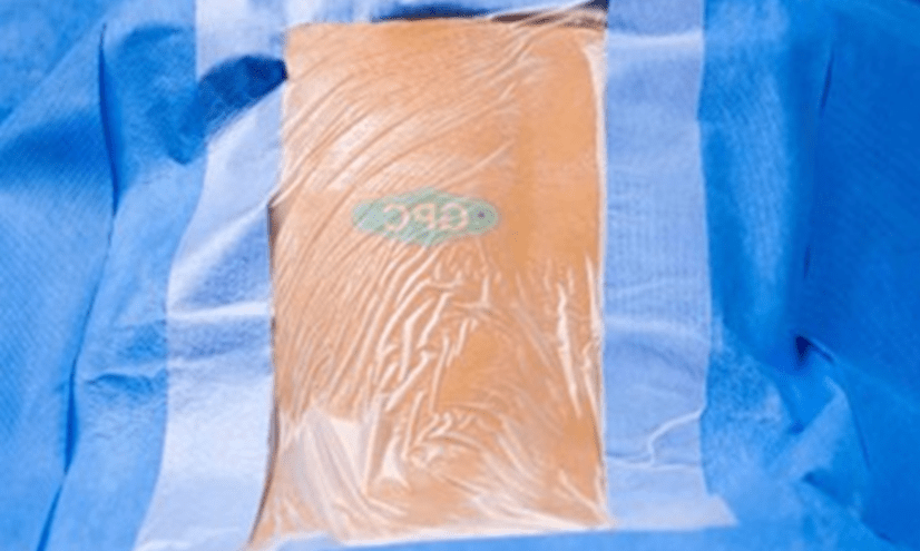 Lamino Spinal Drape