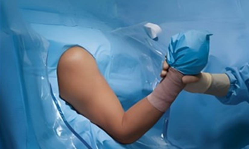 Shoulder Arthroscopy Drape